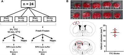 Can We Use 2,3,5-Triphenyltetrazolium Chloride-Stained Brain Slices for Other Purposes? The Application of Western Blotting